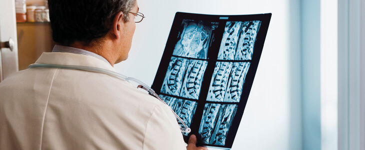 A doctor examining a patient's spinal cord injury scan
