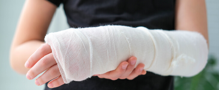 Young woman with a bandaged arm after suffering a burn
