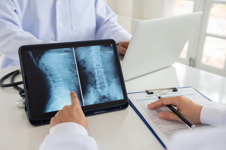 Doctor examining x-ray of spine